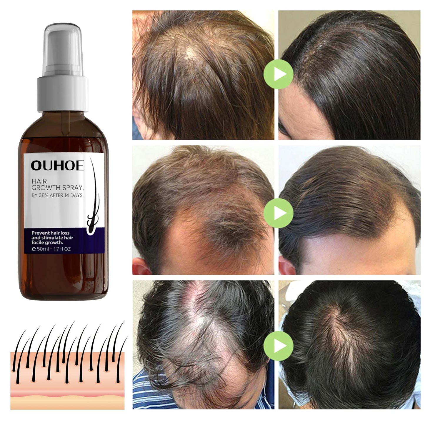 BibeZap™ - Hair Growth Serum