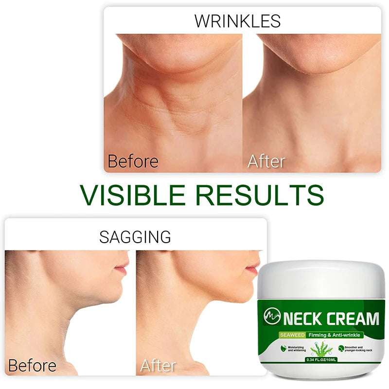 Cervon™ - Neck Cream